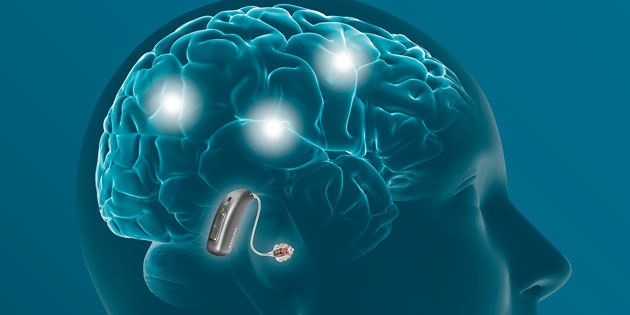 Neue BrainHearing-Info-Materialien von Oticon